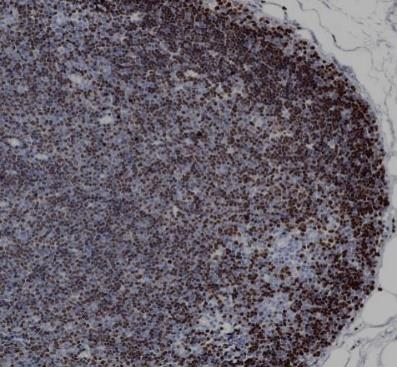 TdT Recombinant antibody