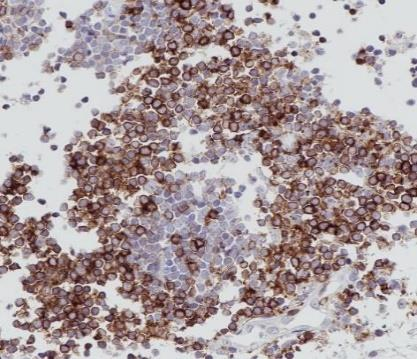 CD5 Recombinant antibody