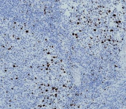 Phospho histone H3 Recombinant antibody