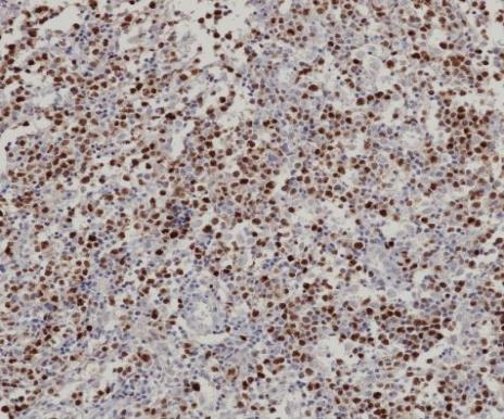 MUM1 Recombinant antibody