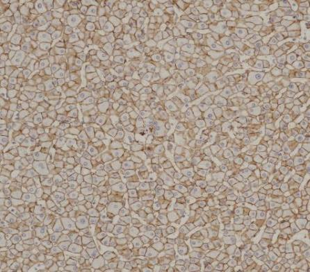 N-Cadherin Recombinant antibody