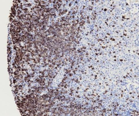 CD7 Recombinant antibody