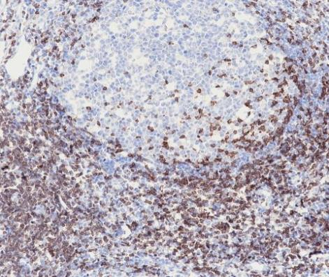 ZAP-70 Recombinant antibody