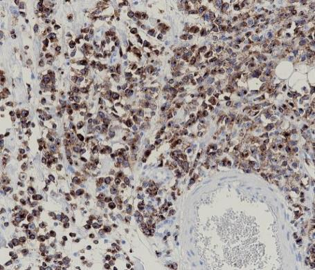 CD2 Recombinant antibody