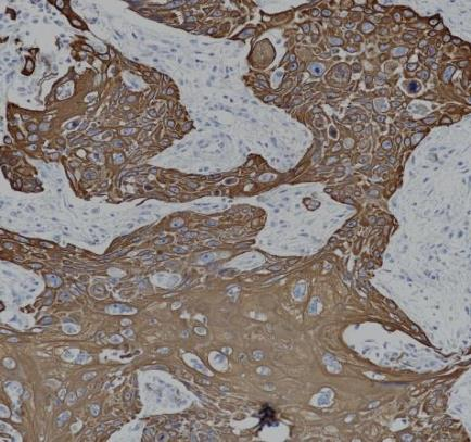 Cytokeratin 17 Recombinant antibody