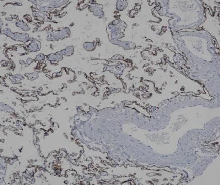 Podoplanin Recombinant antibody