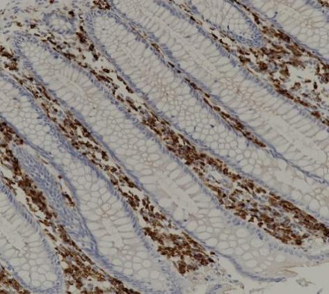 CD14Recombinant antibody