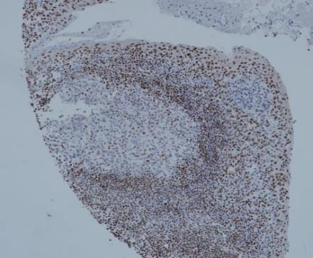 FOXP1 Recombinant antibody