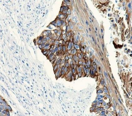 Cytokeratin (HMW) Recombinant antibody