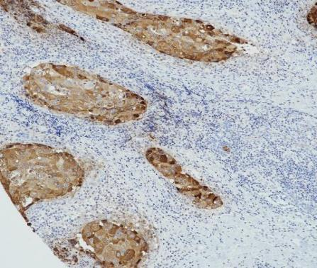 GCDFP-15 Recombinant antibody