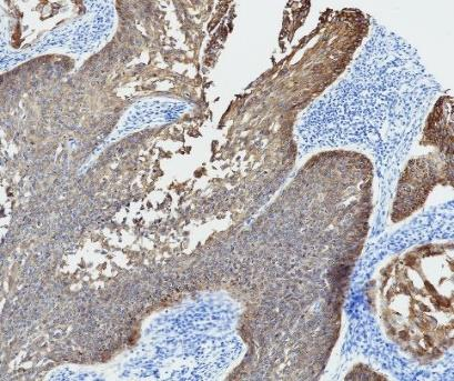 MUC4 Recombinant antibody