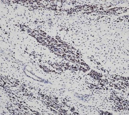 Myo D1 Recombinant antibody