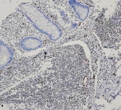 ERG Recombinant antibody
