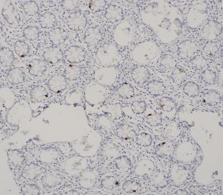 Chromogranin A Recombinant antibody