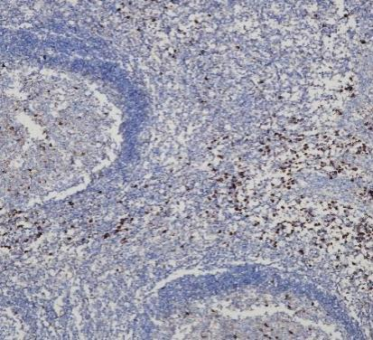 Lambda Light Chains Recombinant antibody