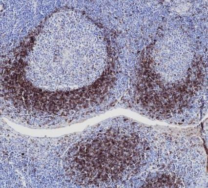 IgM Recombinant antibody