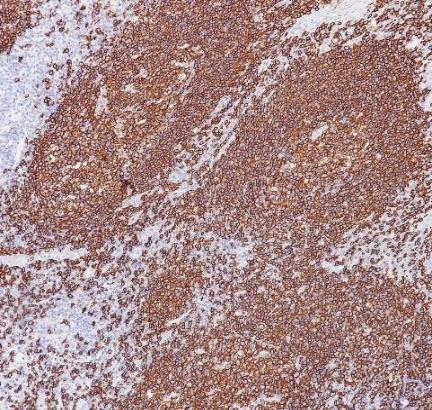 CD20 Recombinant antibody