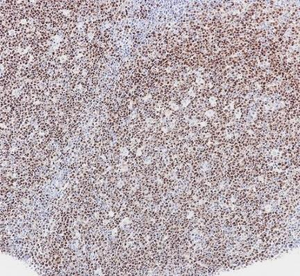 PAX-5 Recombinant antibody