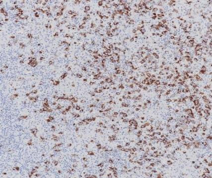 CD15 Monoclonal antibody 
