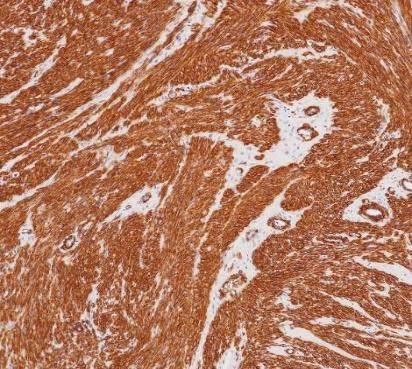 a-SMA Monoclonal antibody