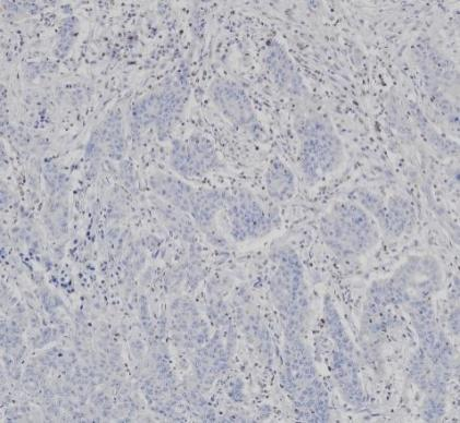 MSH2 Monoclonal antibody