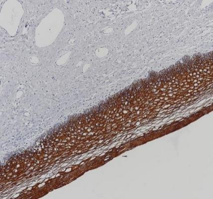 Cytokeratin 5&6 Recombinant antibody