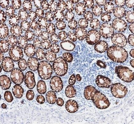Cytokeratin 8&18 Recombinant antibody