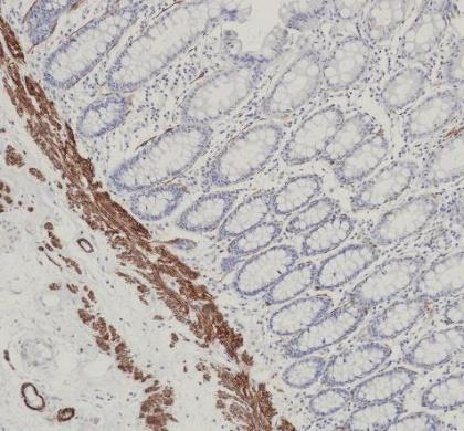 Caldesmon Monoclonal antibody