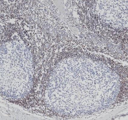 Bcl-2 Monoclonal antibody