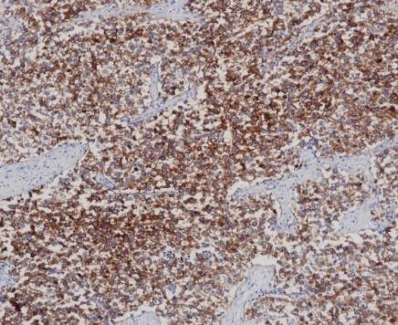 PLAP Monoclonal antibody