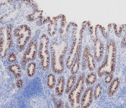 MUC2 Monoclonal antibody