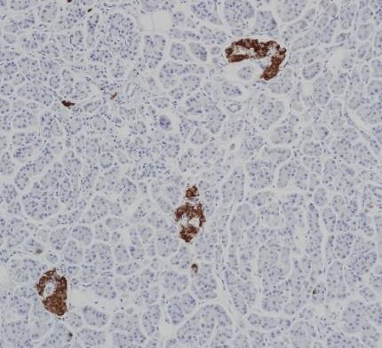 Insulin Monoclonal antibody