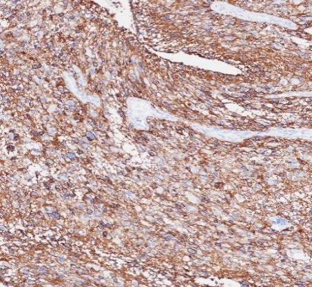 CD56 Recombinant antibody