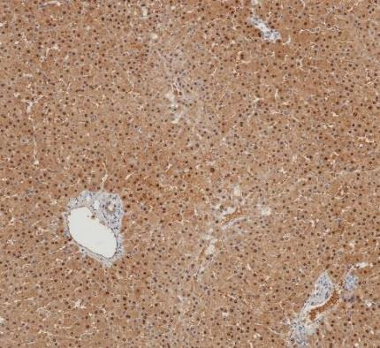 Arginase-1 Recombinant antibody