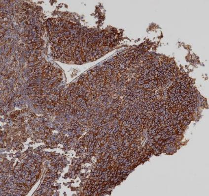 CD146 Recombinant antibody