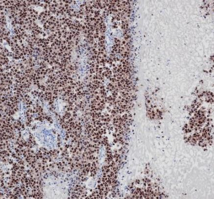 Oct-34 Recombinant antibody