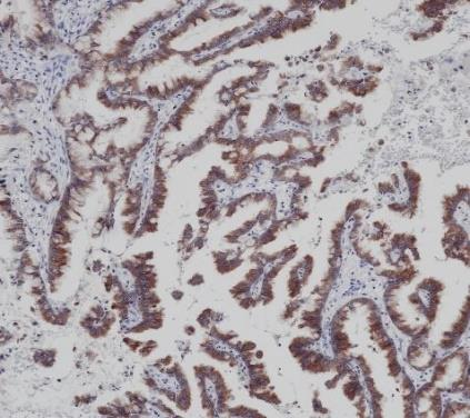 ALK Recombinant antibody