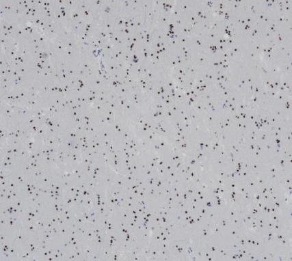 Olig2 Recombinant antibody