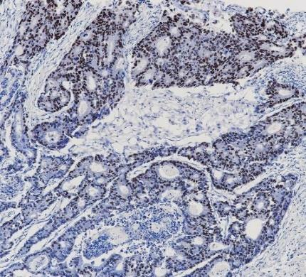 PAX-5 Monoclonal antibody