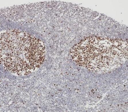 Ki67 Recombinant antibody