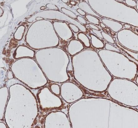 TPO Monoclonal antibody
