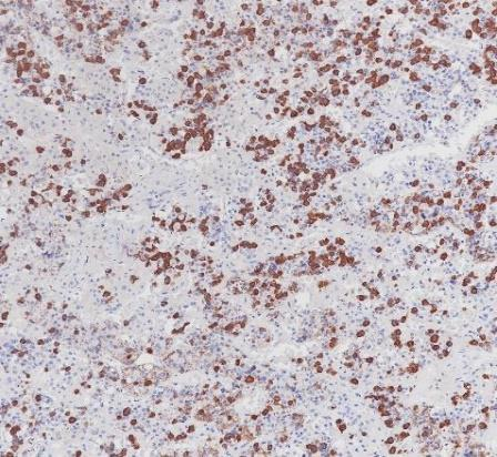 Growth Hormone Monoclonal antibody