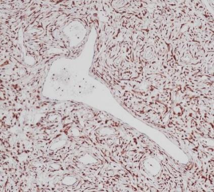 STAT6 Recombinant antibody