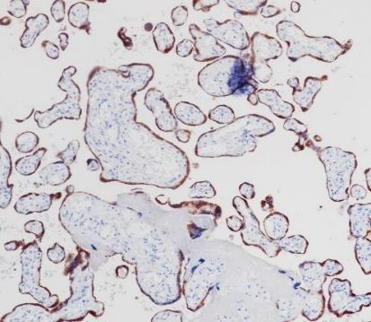 hCG?beta?Recombinant antibody