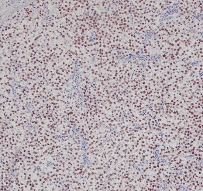 SALL4 Recombinant antibody