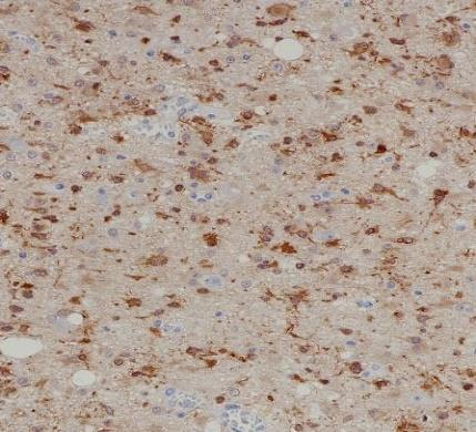 IDH1 R132H Recombinant antibody