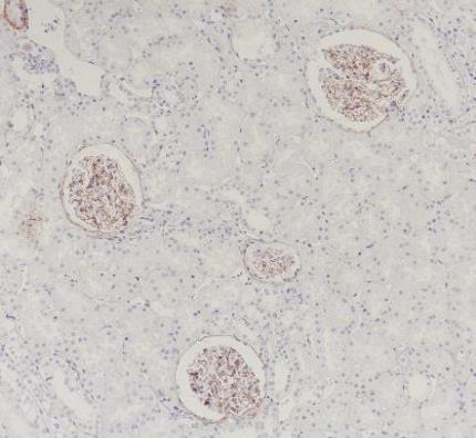 COL4A5 Recombinant antibody