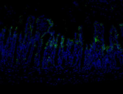 Claudin 1 Recombinant antibody