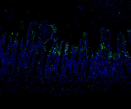 Claudin 1 Recombinant antibody