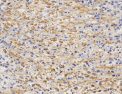 Hsp70 Recombinant antibody